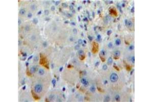 Used in DAB staining on fromalin fixed paraffin-embedded Liver tissue (SIGLEC7 Antikörper  (AA 381-467))