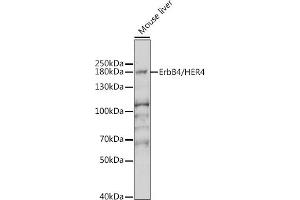 Western blot analysis of extracts of mouse brain, using ErbB4/HER4 antibody (ABIN6131263, ABIN6140257, ABIN6140260 and ABIN6221732) at 1:1000 dilution. (ERBB4 Antikörper  (AA 26-160))