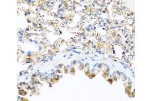 Immunohistochemistry of paraffin-embedded Mouse lung using PI3 Polyclonal Antibody at dilution of 1:100 (40x lens). (PI3 Antikörper)