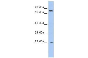 NHLRC2 antibody used at 1 ug/ml to detect target protein. (NHLRC2 Antikörper  (N-Term))