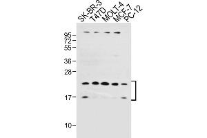 All lanes : Anti-UBE2W Antibody (C-term) at 1:1000 dilution Lane 1: SK-BR-3 whole cell lysate Lane 2: T47D whole cell lysate Lane 3: MOLT-4 whole cell lysate Lane 4: MCF-7 whole cell lysate Lane 5: PC-12 whole cell lysate Lysates/proteins at 20 μg per lane. (UBE2W Antikörper  (C-Term))
