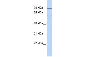 WB Suggested Anti-TIPARP Antibody Titration:  0.