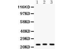 Western Blotting (WB) image for anti-Peroxiredoxin 5 (PRDX5) (AA 66-198) antibody (ABIN3043906) (Peroxiredoxin 5 Antikörper  (AA 66-198))