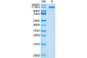 Human Her2 on Tris-Bis PAGE under reduced condition. (ErbB2/Her2 Protein (AA 23-652) (Fc Tag))