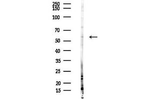Western blot analysis of lysates from Hela cells(heat-shock,45 min treatment), using XIAP Antibody at 1/1000 dilution.
