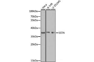 Western blot analysis of extracts of various cell lines using SGTA Polyclonal Antibody at dilution of 1:1000. (SGTA Antikörper)
