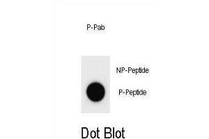 Dot blot analysis of Mouse p21Cip1 Antibody (Phospho ) Phospho-specific Pab (ABIN1881616 and ABIN2837842) on nitrocellulose membrane.