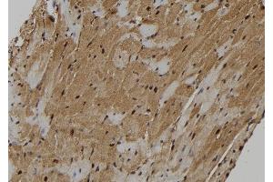 ABIN6262804 and ABIN6273130 at 1/100 staining Mouse heart tissue by IHC-P. (KIF18A Antikörper  (Internal Region))