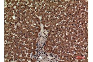 Immunohistochemistry (IHC) image for anti-CD3 epsilon (CD3E) (Internal Region) antibody (ABIN6283246)