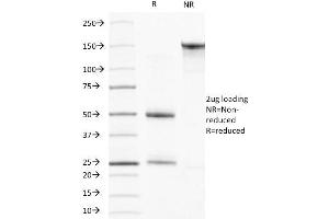 SDS-PAGE Analysis Purified Muscle Specific Actin Mouse Monoclonal Antibody (HHF35). (ACTA1/ACTA2A/ACTG2 Antikörper)