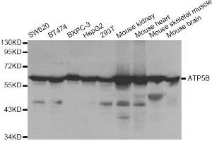 Western blot analysis of extracts of various cell lines, using ATP5B antibody.