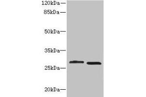 Western blot All lanes: CRYBB1 antibody at 1. (CRYBB1 Antikörper  (AA 1-252))