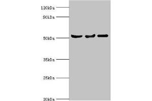 Western blot All lanes: Protein Z-dependent protease inhibitor antibody at 3 μg/mL Lane 1: Mouse liver tissue Lane 2: HepG2 whole cell lysate Lane 3: LO2 whole cell lysate Secondary Goat polyclonal to rabbit IgG at 1/10000 dilution Predicted band size: 51 kDa Observed band size: 51 kDa (SERPINA1 Antikörper  (AA 165-444))