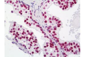 Human Prostate: Formalin-Fixed, Paraffin-Embedded (FFPE)