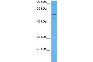 Host:  Rabbit  Target Name:  TLE1  Sample Tissue:  Mouse Spleen  Antibody Dilution:  1ug/ml (TLE1 Antikörper  (N-Term))