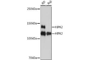 Western blot analysis of extracts of various cell lines, using HIPK2 Rabbit mAb (ABIN7267779) at 1:1000 dilution. (HIPK2 Antikörper)