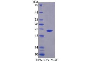 SDS-PAGE (SDS) image for phosphorylase, Glycogen, Liver (PYGL) (AA 341-509) protein (His tag) (ABIN1170566)
