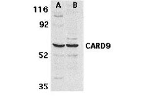 Western Blotting (WB) image for anti-Caspase Recruitment Domain Family, Member 9 (CARD9) antibody (ABIN1031698) (CARD9 Antikörper)