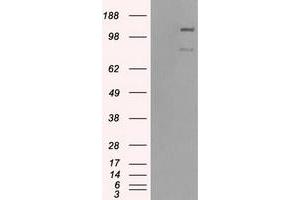 HEK293T cells were transfected with the pCMV6-ENTRY control (Left lane) or pCMV6-ENTRY BUB1B (Right lane) cDNA for 48 hrs and lysed. (BUB1B Antikörper)