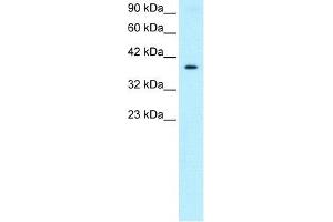 Human HepG2; WB Suggested Anti-NT5C3 Antibody Titration: 0.