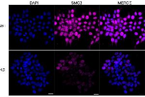 Immunocytochemical staining of HeLa cells using SMC3 antibody (ABIN7800448), 1:1,000), Top panel: wild-type (WT), Bottom panal: SMC3 shRNA knockdown (KD). (Rekombinanter SMC3 Antikörper)