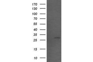 Image no. 1 for anti-Src-like-adaptor 2 (SLA2) antibody (ABIN1500952) (SLAP2 Antikörper)