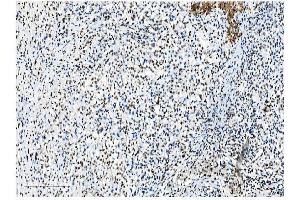 IHC analysis of NRF1 using anti-NRF1 antibody (ABIN7600874). (NRF1 Antikörper  (AA 246-503))