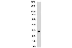 Western blot testing of Ramos lysate and HLA-DRB1 antibody.