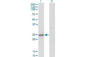 Western Blot analysis of GINS2 expression in transfected 293T cell line by Pfs2 monoclonal antibody (M02), clone 3H4. (GINS2 Antikörper  (AA 1-100))