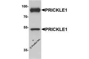 Western Blotting (WB) image for anti-Prickle-Like Protein 1 (PRICKLE1) (C-Term) antibody (ABIN1077370) (PRICKLE1 Antikörper  (C-Term))