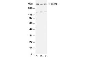 Western blot testing of ATM antibody and Lane 1:  rat testis (ATM Antikörper  (N-Term))