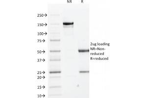 SDS-PAGE Analysis Purified Cytokeratin 1 Mouse Monoclonal Antibody (KRT1/1840). (Cytokeratin 1 Antikörper)