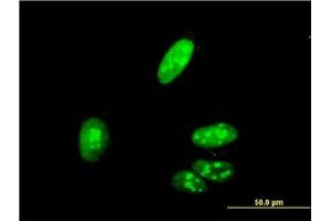 Image no. 3 for anti-Zic Family Member 4 (ZIC4) (AA 249-320) antibody (ABIN466253) (ZIC4 Antikörper  (AA 249-320))