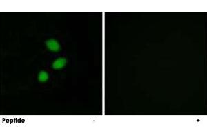 Immunofluorescence analysis of MCF-7 cells, using TSHZ2 polyclonal antibody . (TSHZ2 Antikörper)