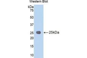 Western blot analysis of the recombinant protein. (IL1RAP Antikörper  (AA 65-249))