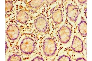 Immunohistochemistry of paraffin-embedded human colon tissue using ABIN7151699 at dilution of 1:100 (ERGIC3 Antikörper  (AA 47-341))