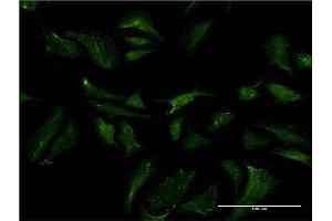 Immunofluorescence of monoclonal antibody to ABCB9 on HeLa cell. (ABCB9 Antikörper  (AA 482-580))