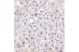Immunohistochemistry of DRAM in human liver tissue with DRAM antibody at 2. (DRAM Antikörper  (C-Term))