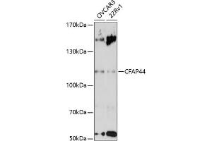 Western blot analysis of extracts of various cell lines, using CF antibody (ABIN7271360) at 1:3000 dilution. (WDR52 Antikörper  (AA 180-370))