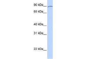 WB Suggested Anti-KIAA0317 Antibody Titration:  0. (AREL1 Antikörper  (Middle Region))