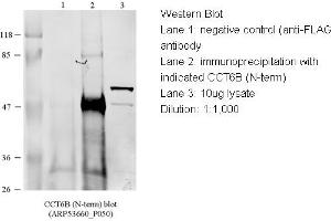 WB Suggested Anti-CCT4 Antibody Titration: 1 ug/mlLane 1: 10ug of HEK293 (CCT6B Antikörper  (N-Term))