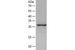 AUH Protein (AA 68-339) (His tag)