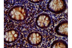 IHC image of ABIN7167024 diluted at 1:700 and staining in paraffin-embedded human appendix tissue performed on a Leica BondTM system. (AKT1 Antikörper  (AA 1-480))