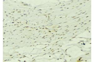 ABIN6272619 at 1/100 staining Mouse muscle tissue by IHC-P. (KALRN Antikörper  (C-Term))