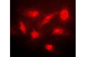Immunofluorescent analysis of IKK beta (pS23) staining in PC12 cells. (IKBKB Antikörper  (N-Term, pSer23))