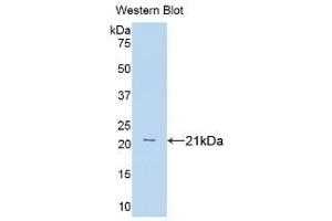 Detection of Recombinant TNFa, Rat using Polyclonal Antibody to Tumor Necrosis Factor Alpha (TNFa) (TNF alpha Antikörper  (AA 80-235))