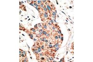 Image no. 2 for anti-RAD9 Homolog A (S. Pombe) (RAD9A) (AA 1-100), (BH3 Domain), (N-Term) antibody (ABIN356831)