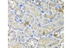 Immunohistochemistry of paraffin-embedded Mouse kidney using USH1C Polyclonal Antibody at dilution of 1:100 (40x lens).