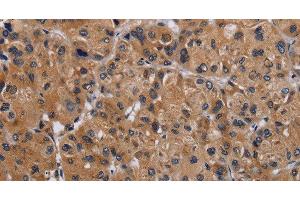 Immunohistochemistry (Paraffin-embedded Sections) (IHC (p)) image for anti-GNAS Complex Locus (GNAS) antibody (ABIN7239926)