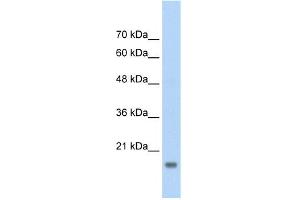 WB Suggested Anti-AMFR Antibody Titration:  2. (AMFR Antikörper  (C-Term))